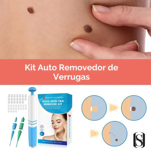 AUTO REMOVEDOR DE VERRUGAS